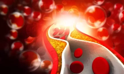 Vienas didžiausių širdies ligų rizikos veiksnių – padidėjęs cholesterolis: gydytoja pataria, kaip užbėgti problemoms už akių