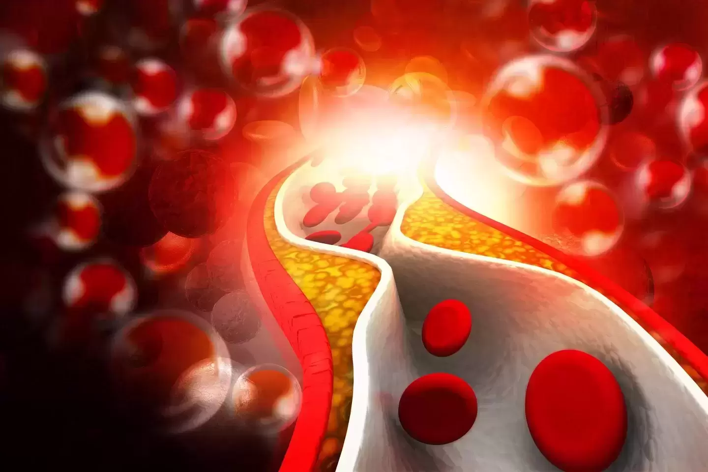 Vienas didžiausių širdies ligų rizikos veiksnių – padidėjęs cholesterolis: gydytoja pataria, kaip užbėgti problemoms už akių