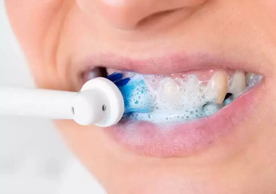 Ką būtina žinoti apie papildomas burnos higienos priemones?