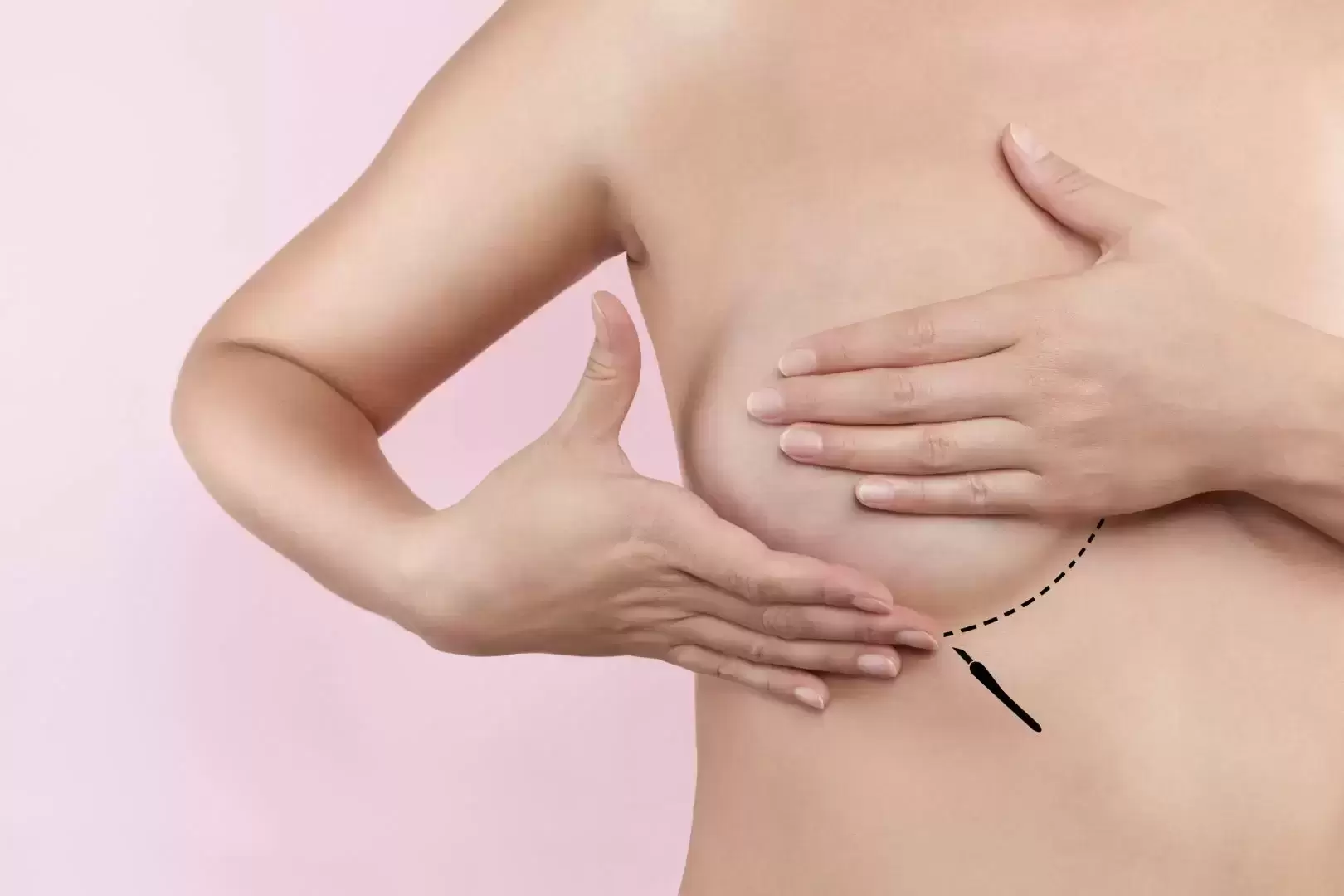 Krūtų implantų sukeliamos ligos: kaip prižiūrėti krūtų implantus ir kada juos keisti?